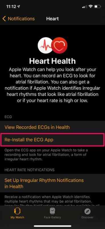 how-to-record-ecg-on-apple-watch-2-369x800-1 how-to-record-ecg-on-apple-watch-2-369x800-1
