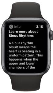how-to-record-ecg-on-apple-watch-7-173x300-1 how-to-record-ecg-on-apple-watch-7-173x300-1