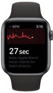 how-to-record-ecg-on-apple-watch-5-173x300-1 how-to-record-ecg-on-apple-watch-5-173x300-1